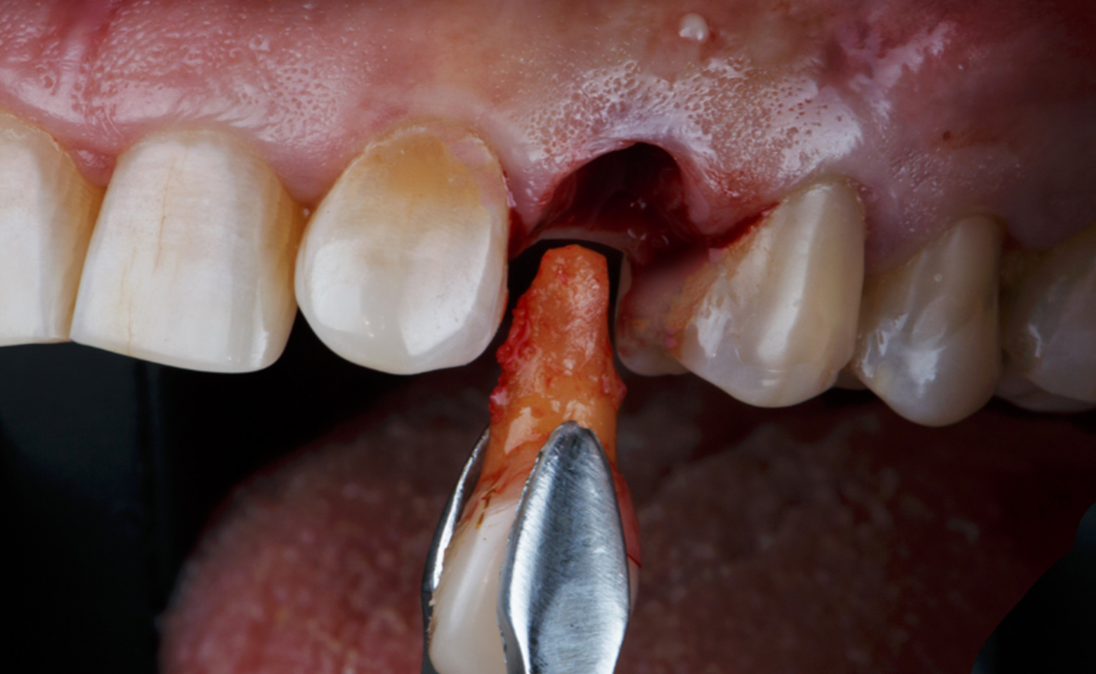 Chirurgia orale | Stomatologica Services