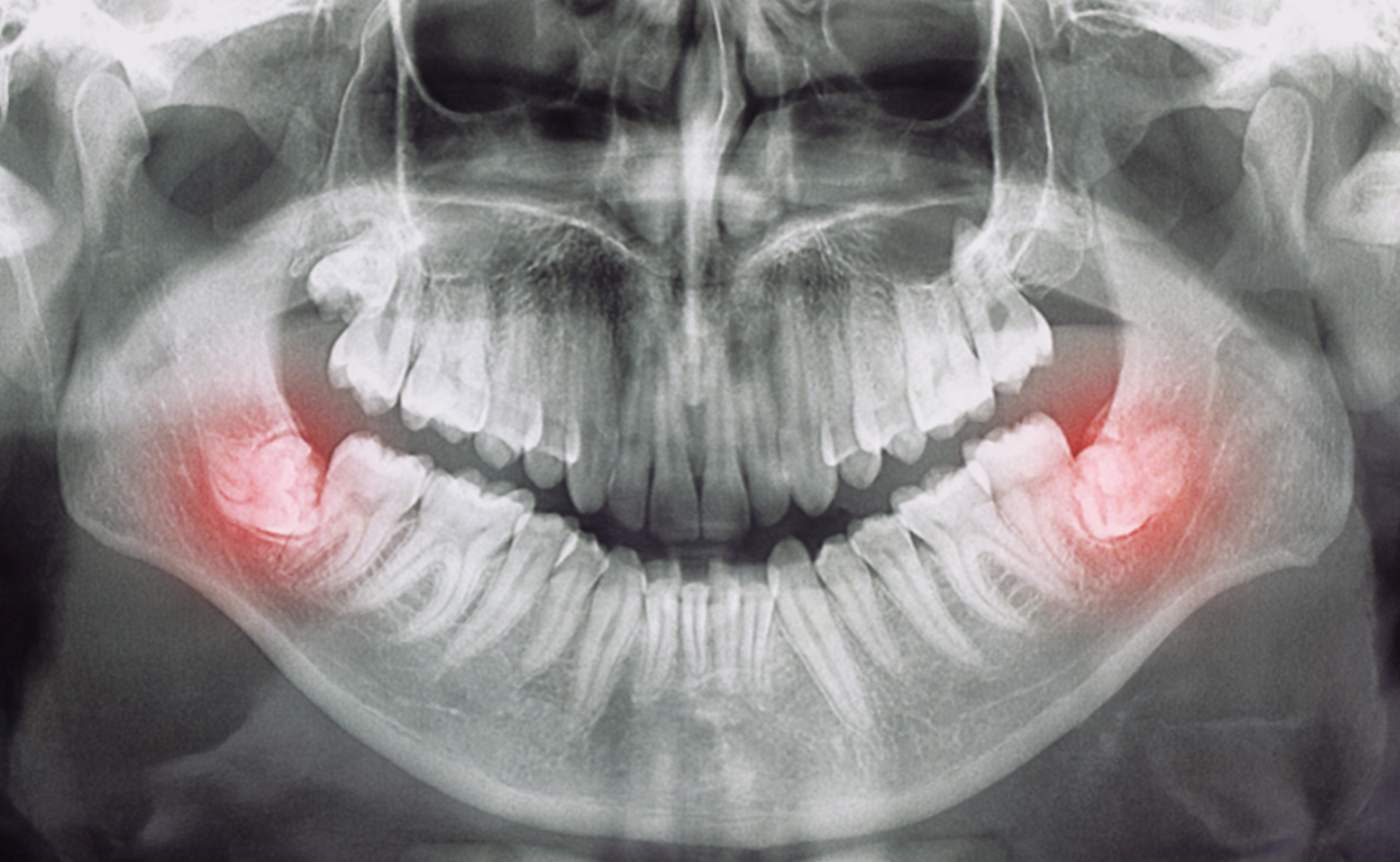 Chirurgia orale | Stomatologica Services