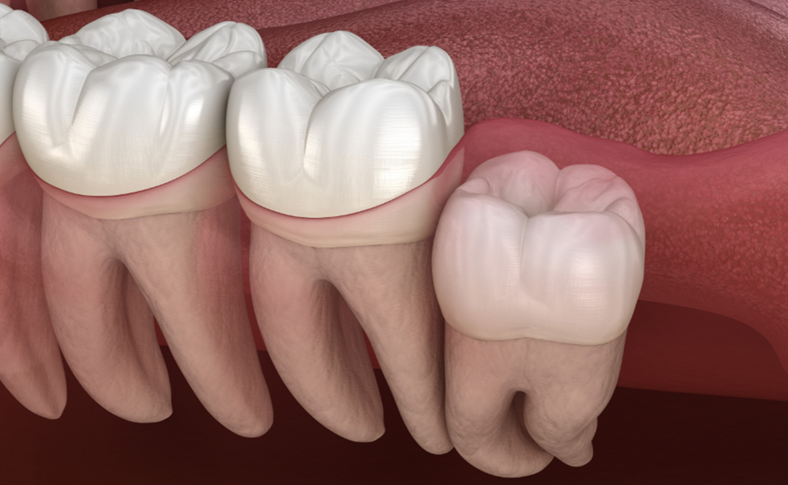 Chirurgia orale | Stomatologica Services