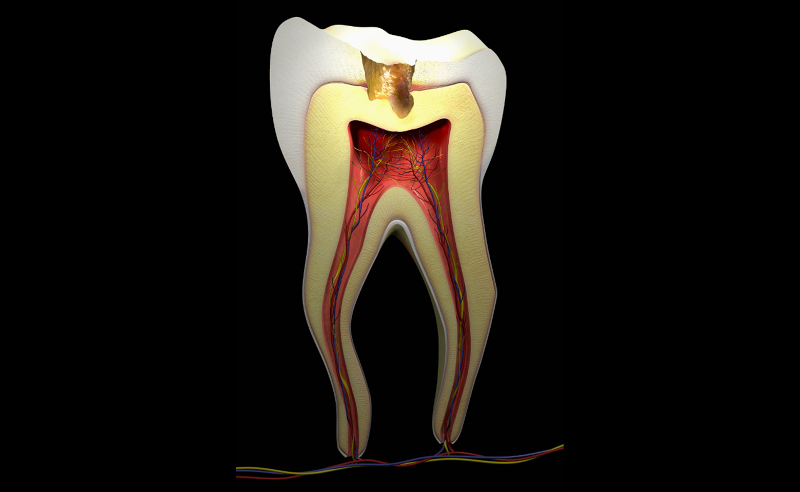 Endodonzia | Stomatologica Services